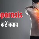 क्या Osteoporosis को रिवर्स किया जा सकता है? नई स्टडी में सामने आई सच्चाई