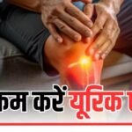 Uric Acid कम करने के लिए खाना शुरू कर दें ये 5 चीजें, कुछ ही दिनों में दिखने लगेगा फायदा