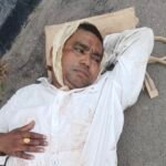 JanjgirChampa Big News : सड़क हादसे में घायल हुए नरियरा भाजपा मंडल अध्यक्ष, पैर में आई गम्भीर चोट